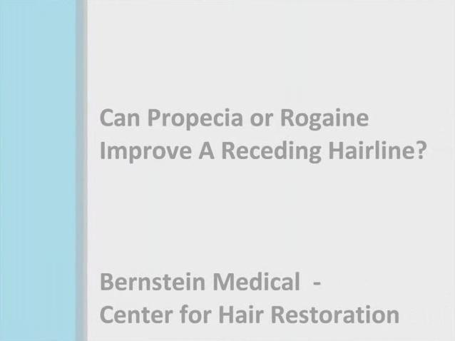 Can Propecia or Rogaine Improve Receding Hairline?